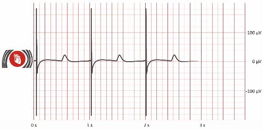 	體外心臟器官芯片模型